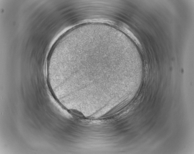 X0000085241084200704092017
