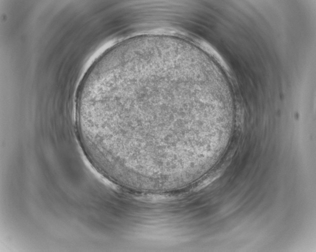 X0000085241095200704092017