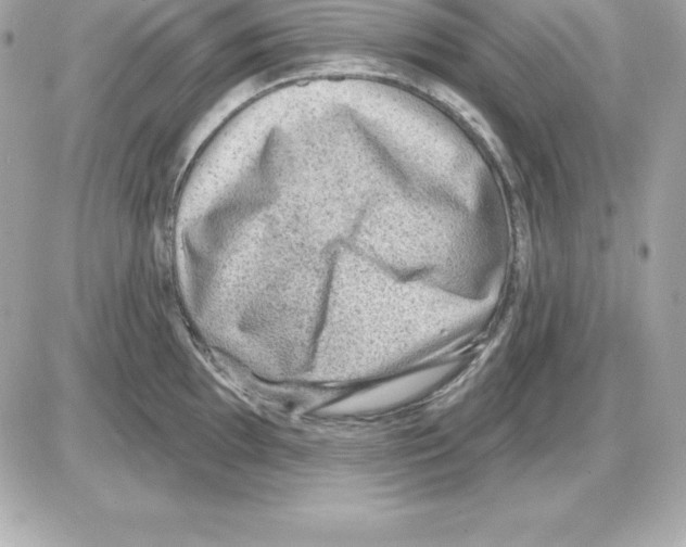 X0000085241097200704092017