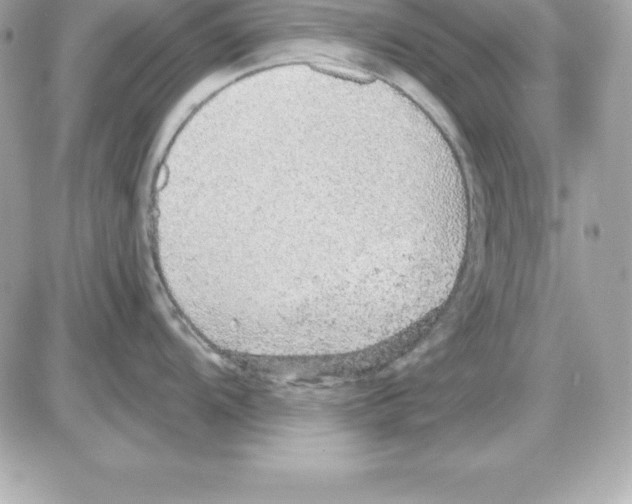 X0000085241104200704092017