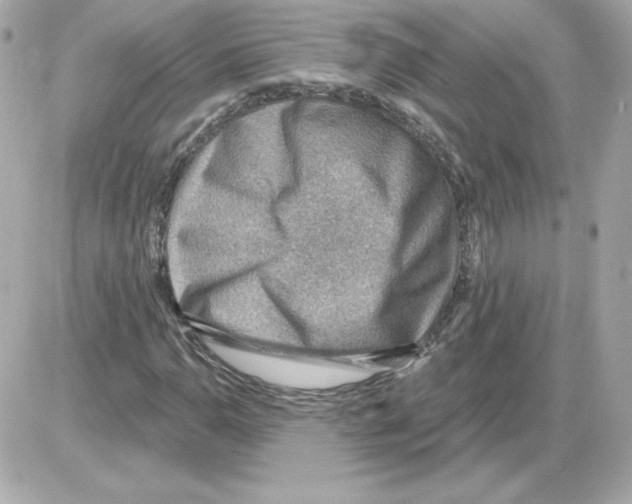 X0000085241110200704092016