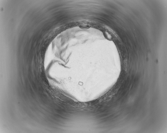 X0000085241111200704092016