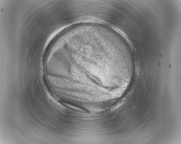 X0000085241120200704092016