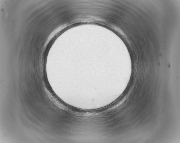 X0000085241122200704092016