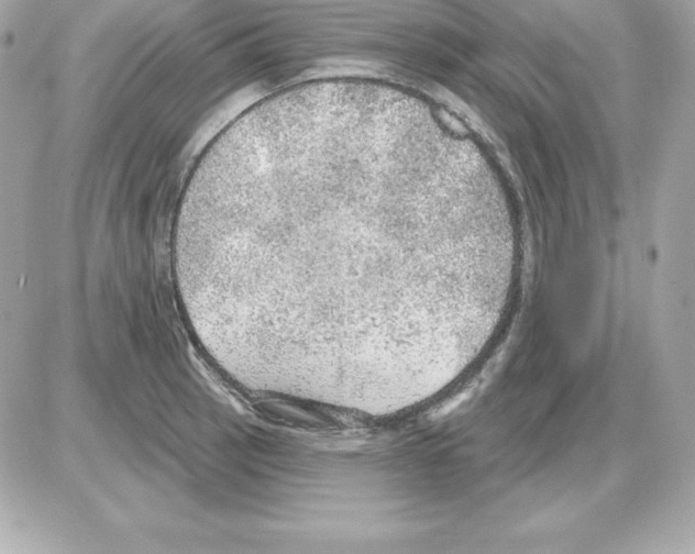 X0000085241137200704092016