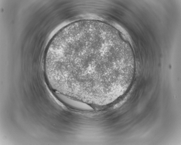 X0000085241141200704092016
