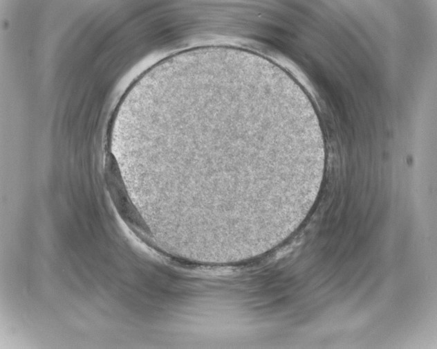 X0000085241143200704092016