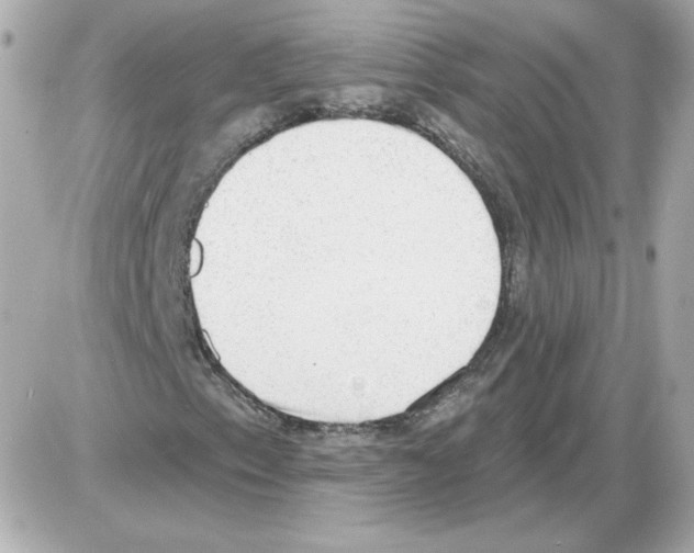 X0000085241153200704092016
