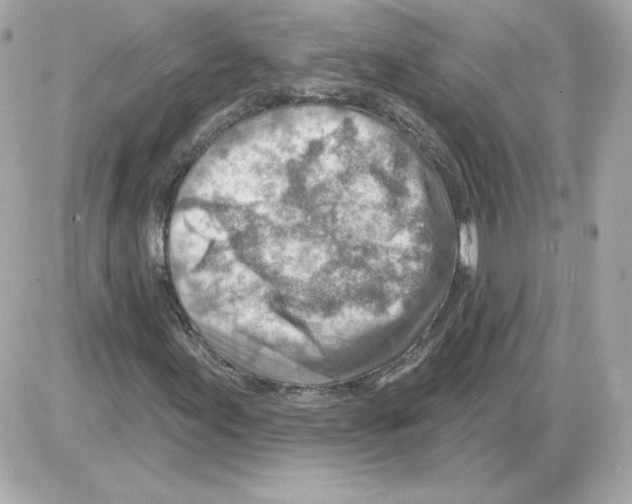 X0000085241155200704092016