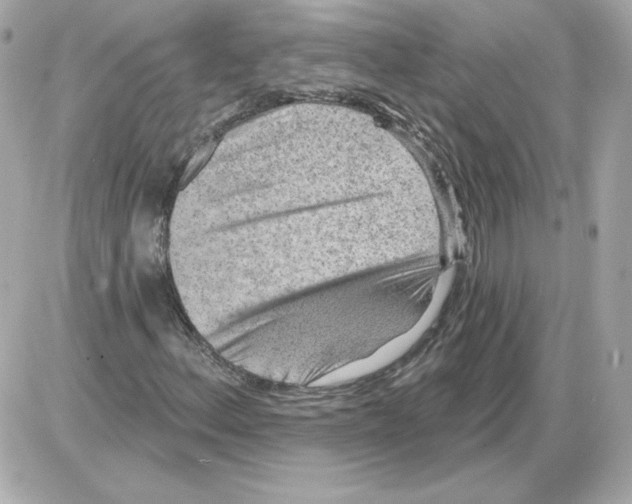 X0000085241156200704092016