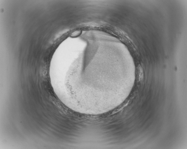 X0000085241158200704092016