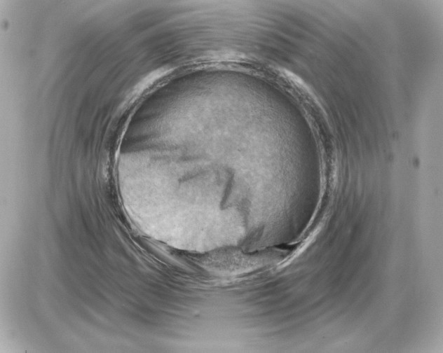 X0000085241161200704092016