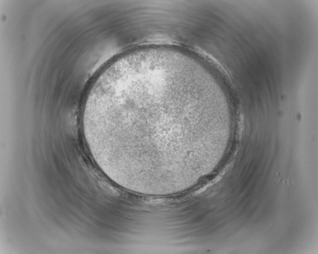 X0000085241162200704092016