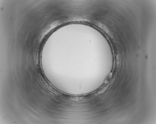 X0000085241165200704092016