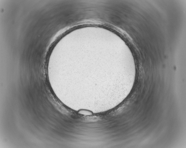 X0000085241168200704092016