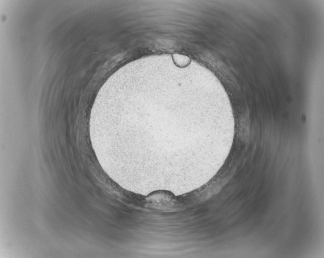 X0000085241201200704092014