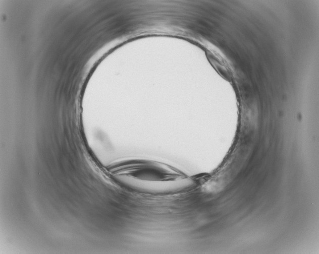 X0000085241238200704092015