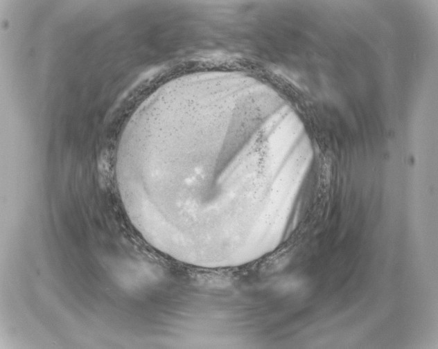 X0000085241254200704092014
