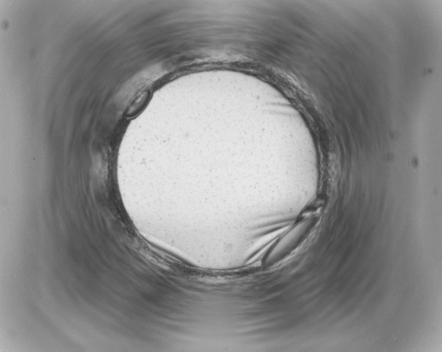 X0000085241257200704092014