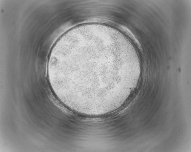 X0000085241276200704092014