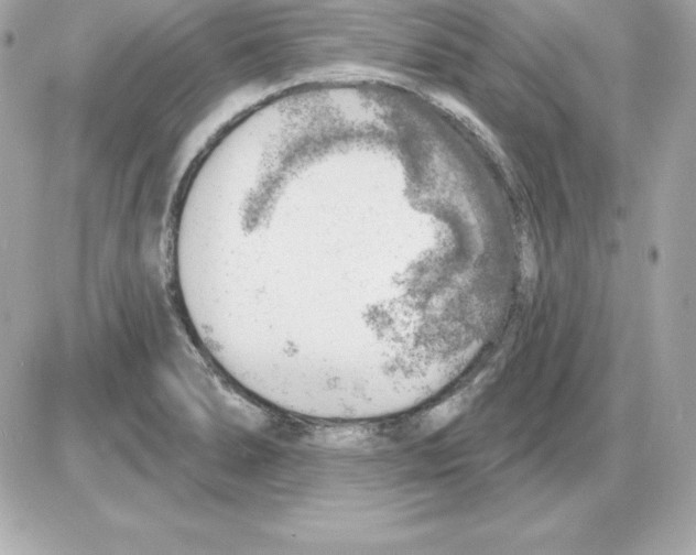 X0000085241278200704092014