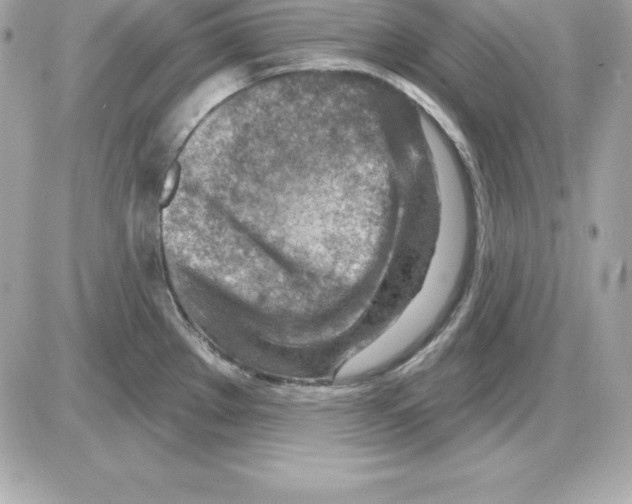 X0000085241289200704092014