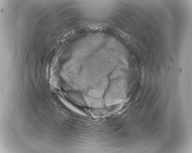 X0000085241394200704092011