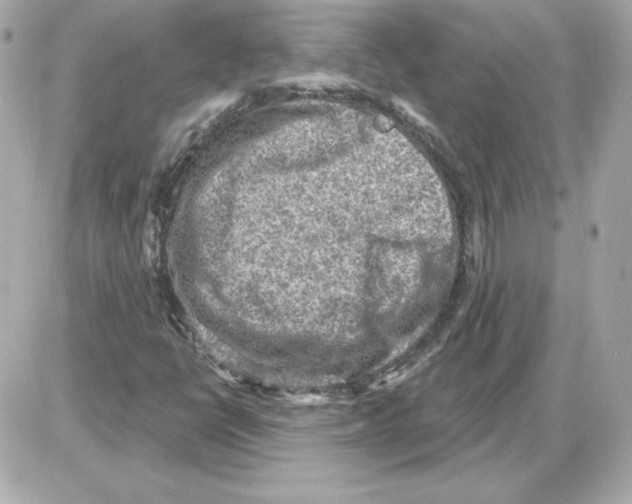 X0000085241398200704092011
