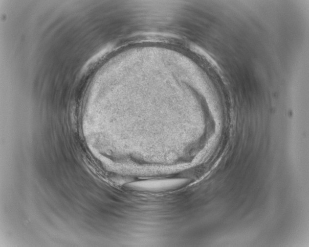 X0000085241403200704092011
