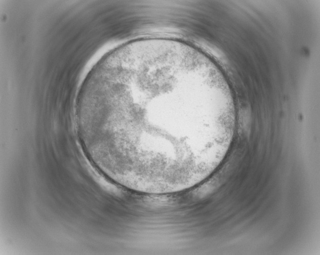 X0000085241470200704092011
