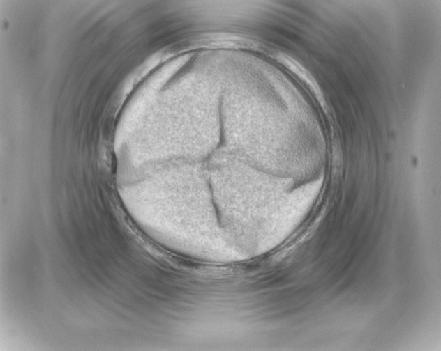 X0000085241481200704092010