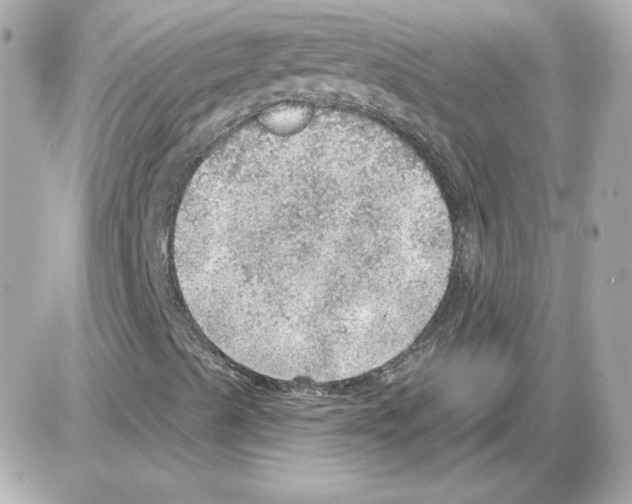 X0000085241489200704092009