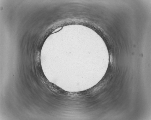 X0000085241492200704092010