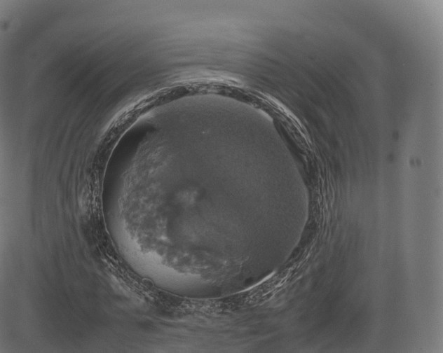 X0000085250775200703091257