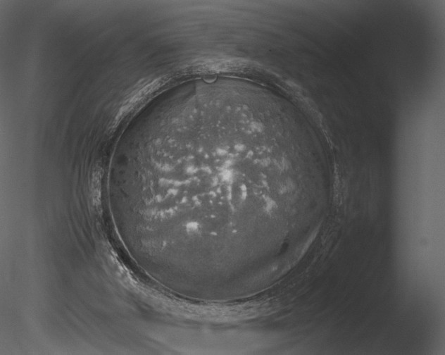 X0000085250010200703161304