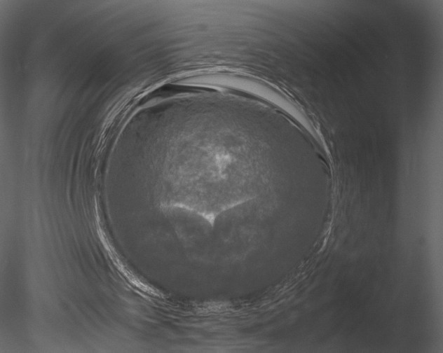 X0000085250097200703161303