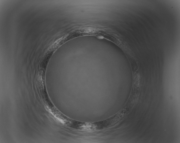 X0000085250415200703161257