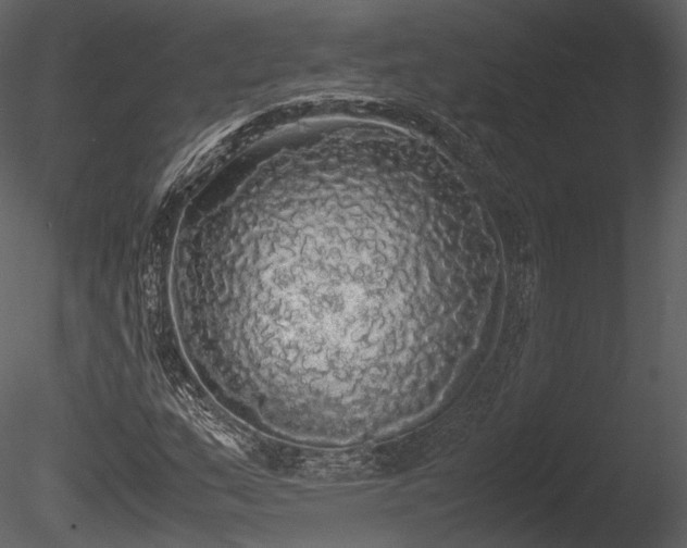 X0000085251159200703161244