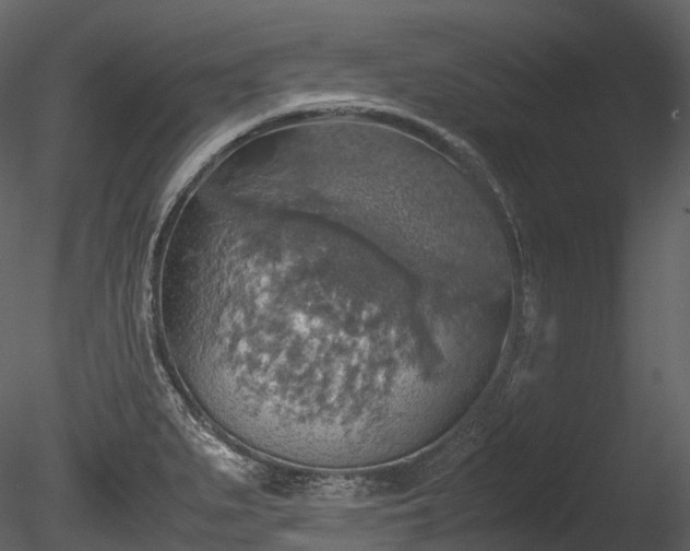 X0000085251279200703161242