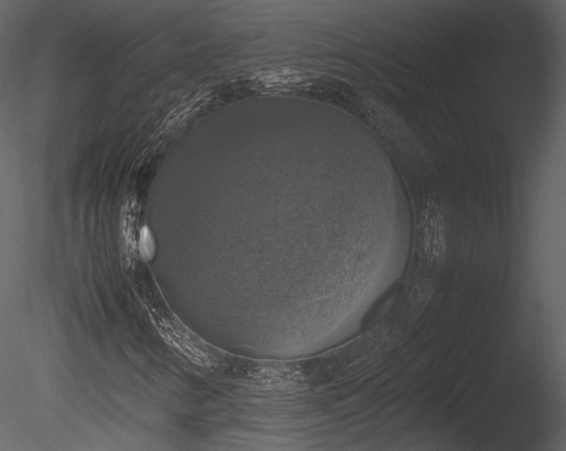 X0000085251346200703161241