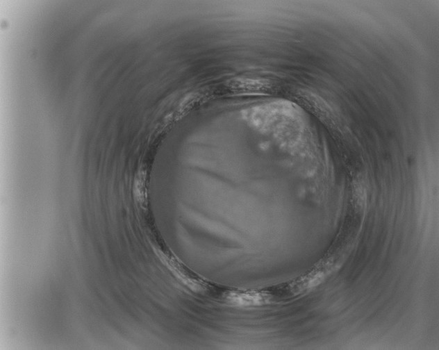 X0000085250181200703231659