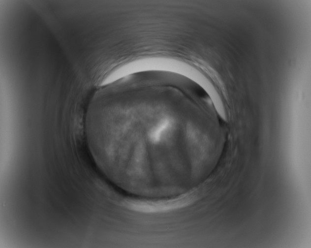 X0000085250017200703301820