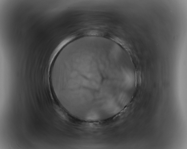 X0000085250147200703301818