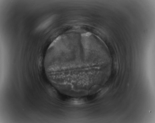 X0000085250275200703301817