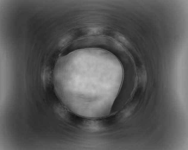 X0000085250276200703301817