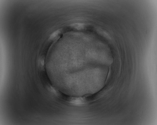 X0000085250288200703301817