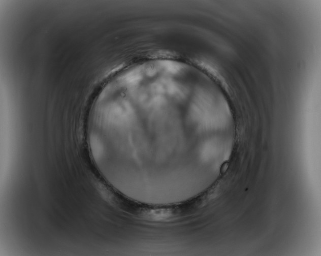 X0000085250353200703301815