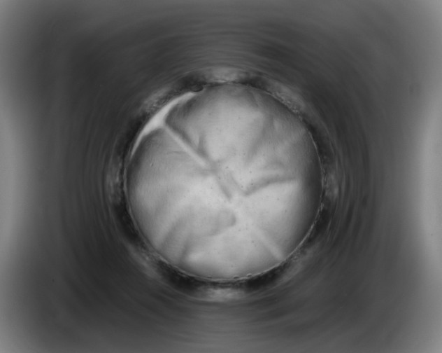 X0000085250360200703301815