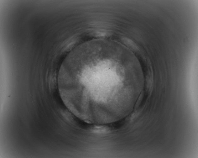 X0000085250376200703301815