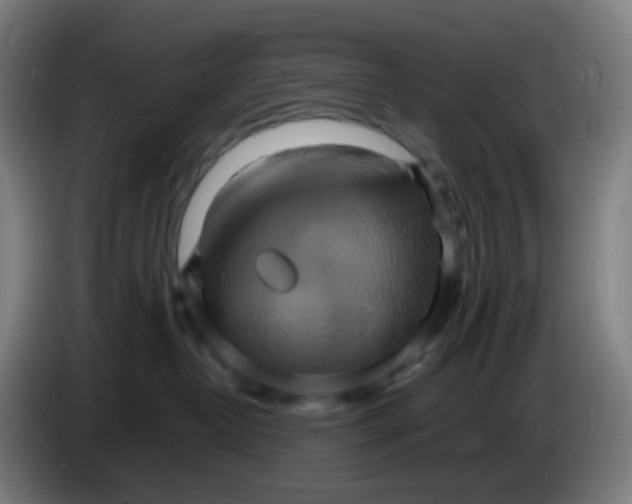 X0000085250382200703301815